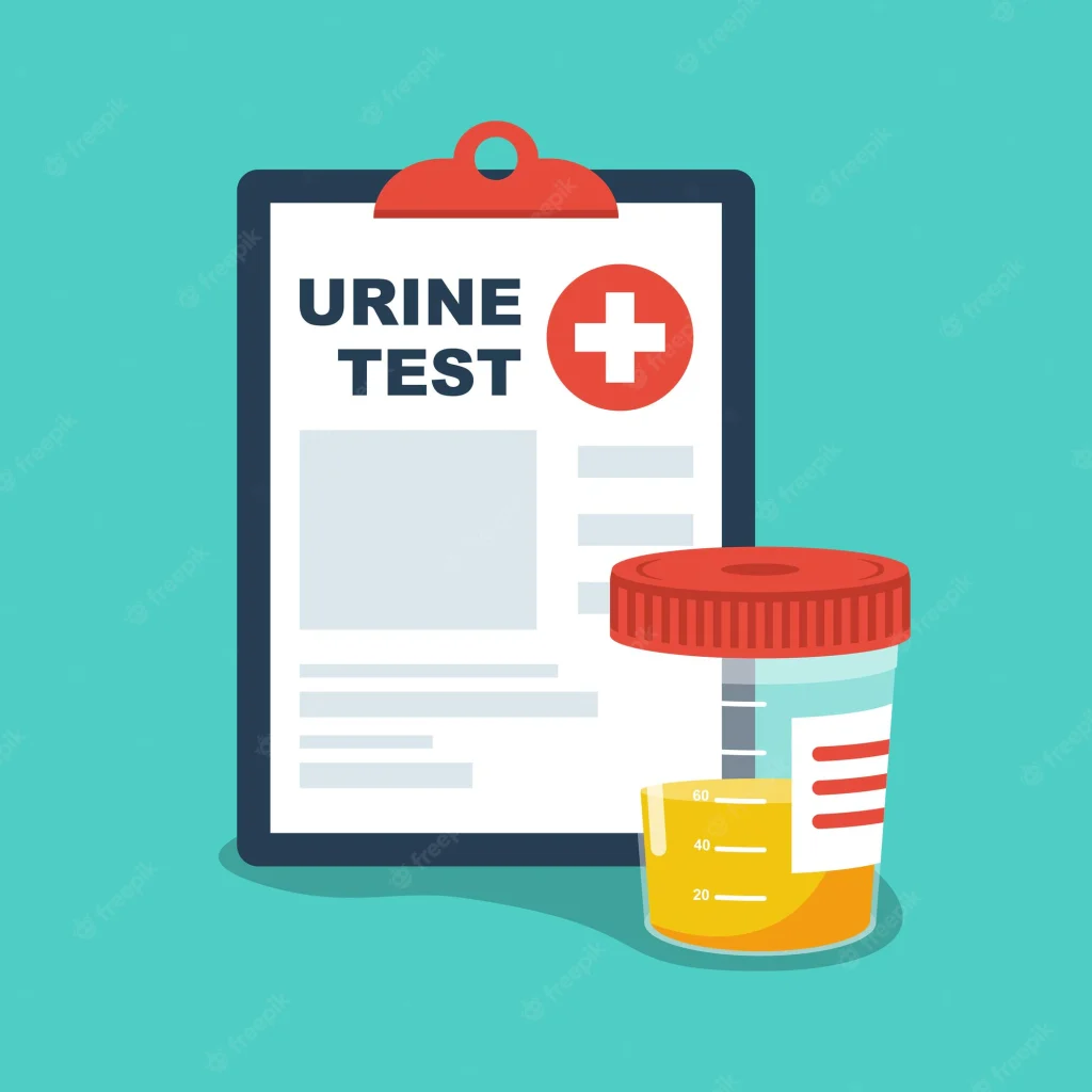 Urine Test Service in Panvel – OM PATHOLOGY LABORATORY